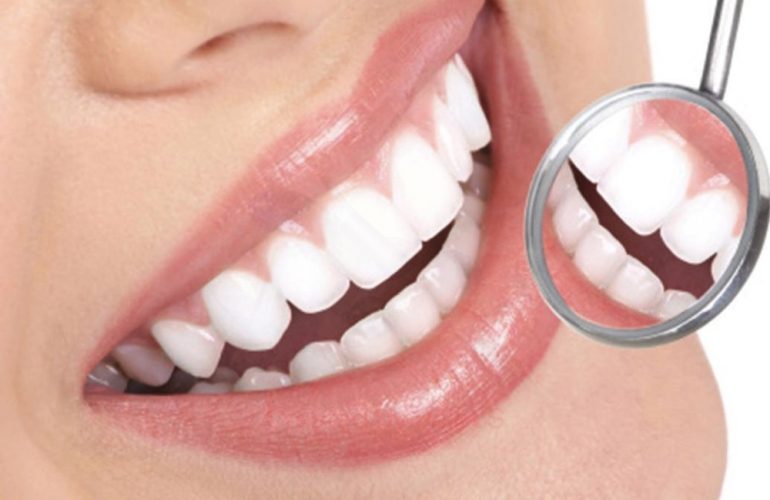 imagen de estetica dental clinica moratalaz 66