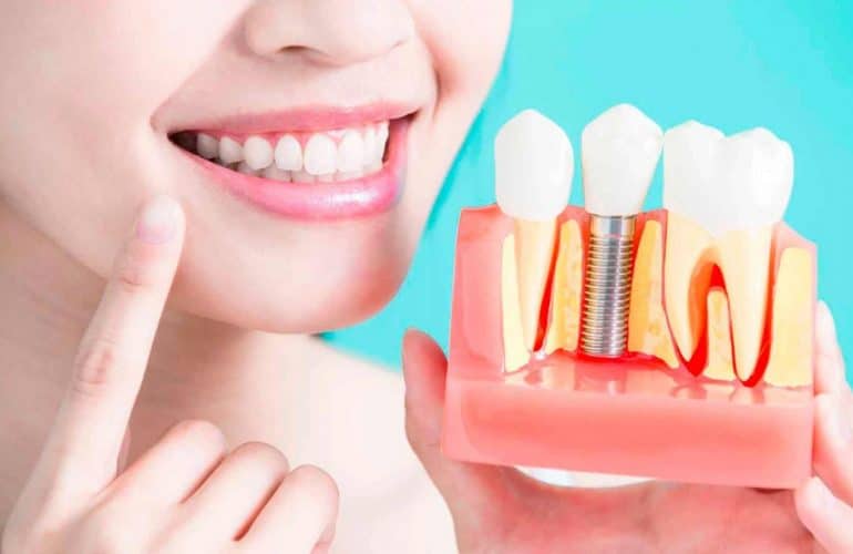 imagen de endodoncia tratamiento clinica doctor omid