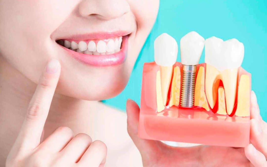 imagen de endodoncia tratamiento clinica doctor omid